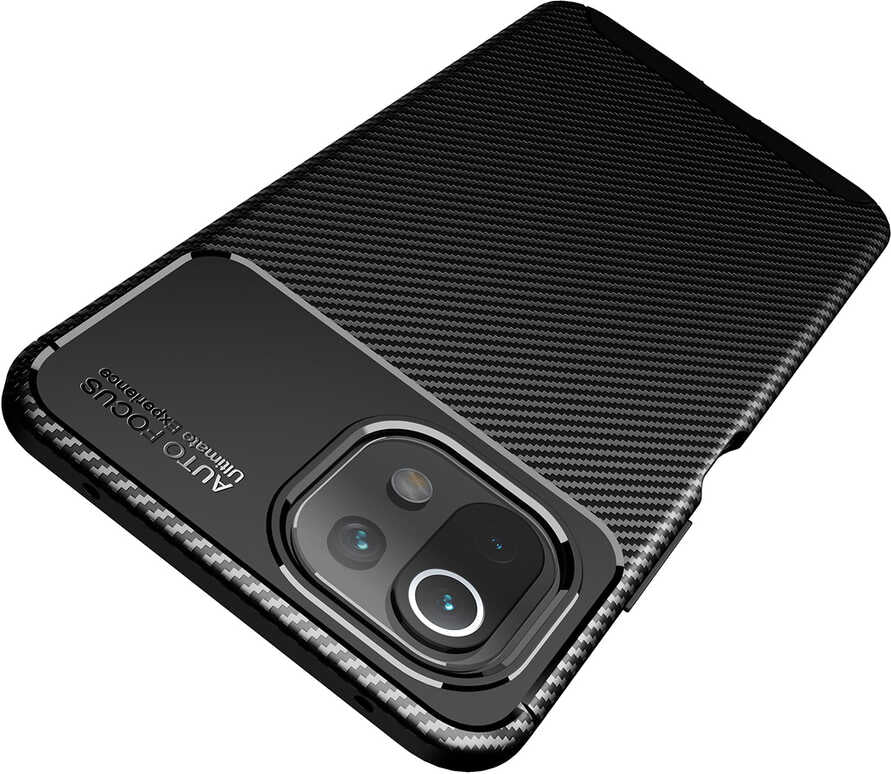 Xiaomi Mi 11 Lite Kılıf Mnc Negro Silikon Kapak-Kahverengi