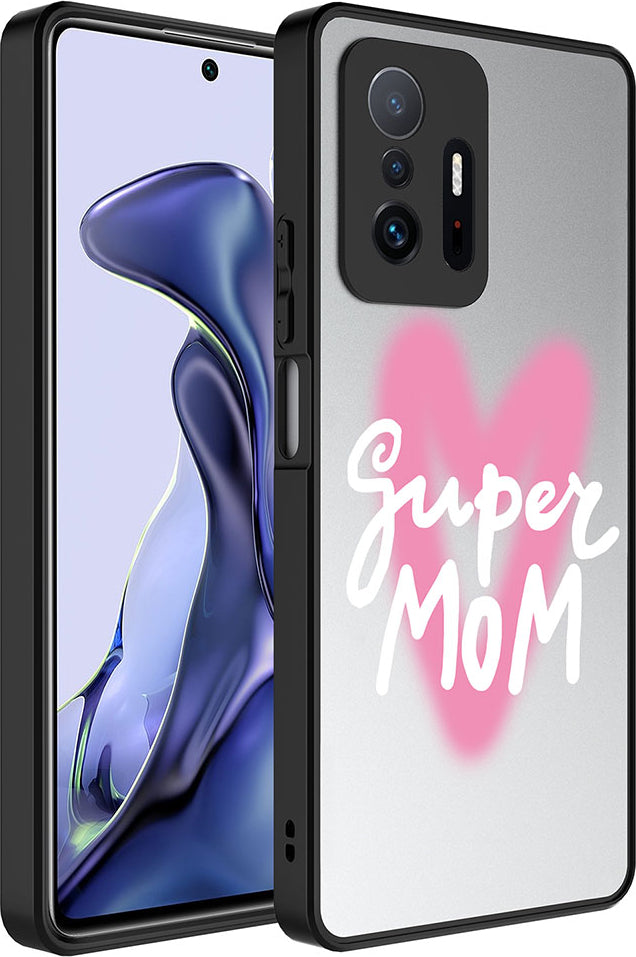 Xiaomi Mi 11T Pro 5g Kılıf Aynalı Desenli Kamera Korumalı Parlak Mnc Mirror Kapak-Süper Anne
